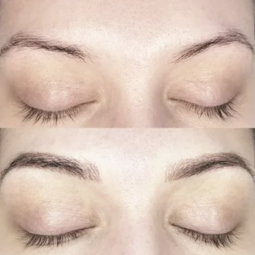 before and after microblading toronto's top brows pretty little secrets beauty 278 jane street